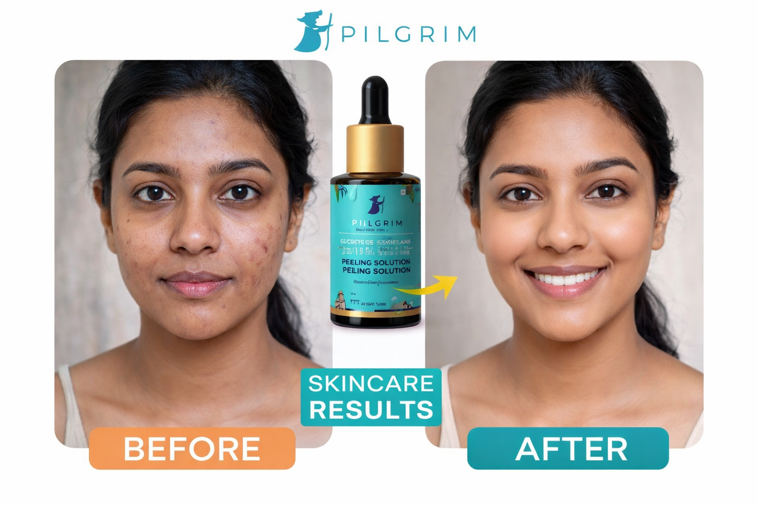 Pilgrim Face Serum – Korean Secrets for Glowing Skin