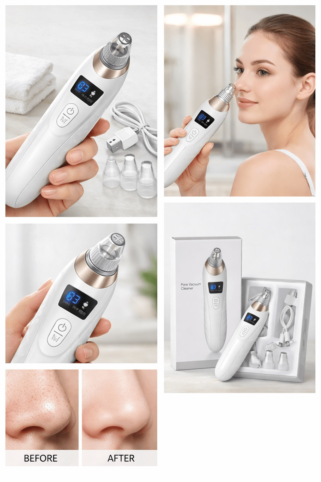 Digital Blackhead Remover Vacuum – Electric Pore Cleaner & Acne Remover - Zovio
