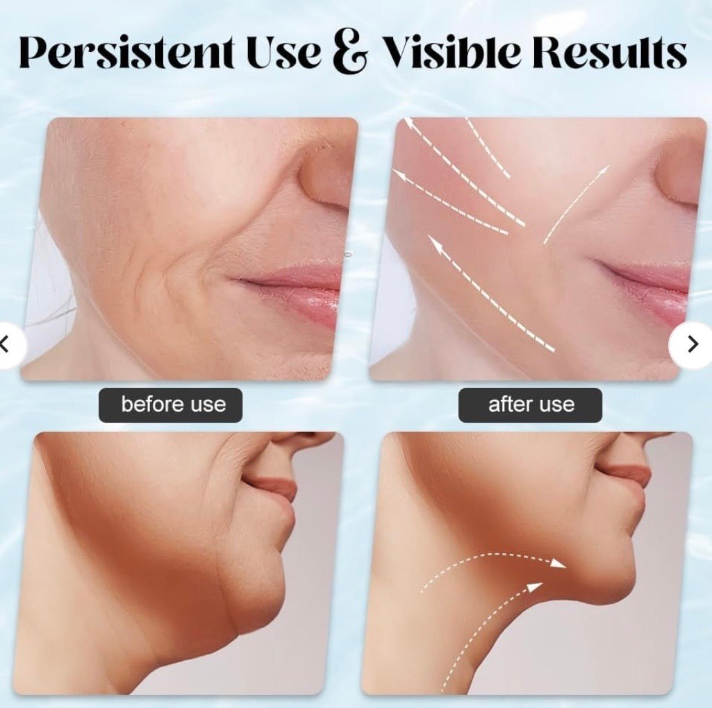 Face Lifting Massager With Red Light Therapy - Zovio