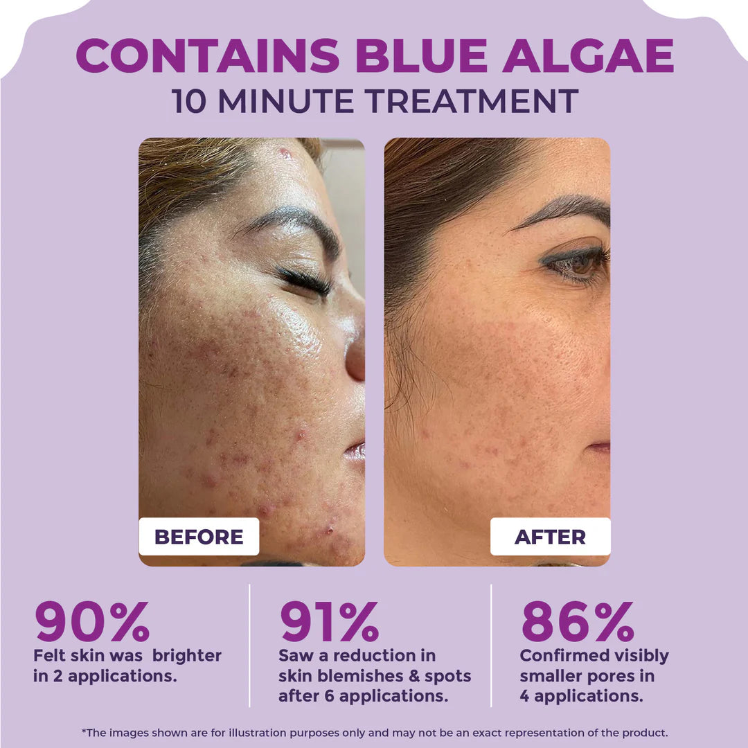 Pilgrim Face Serum – Korean Secrets for Glowing Skin