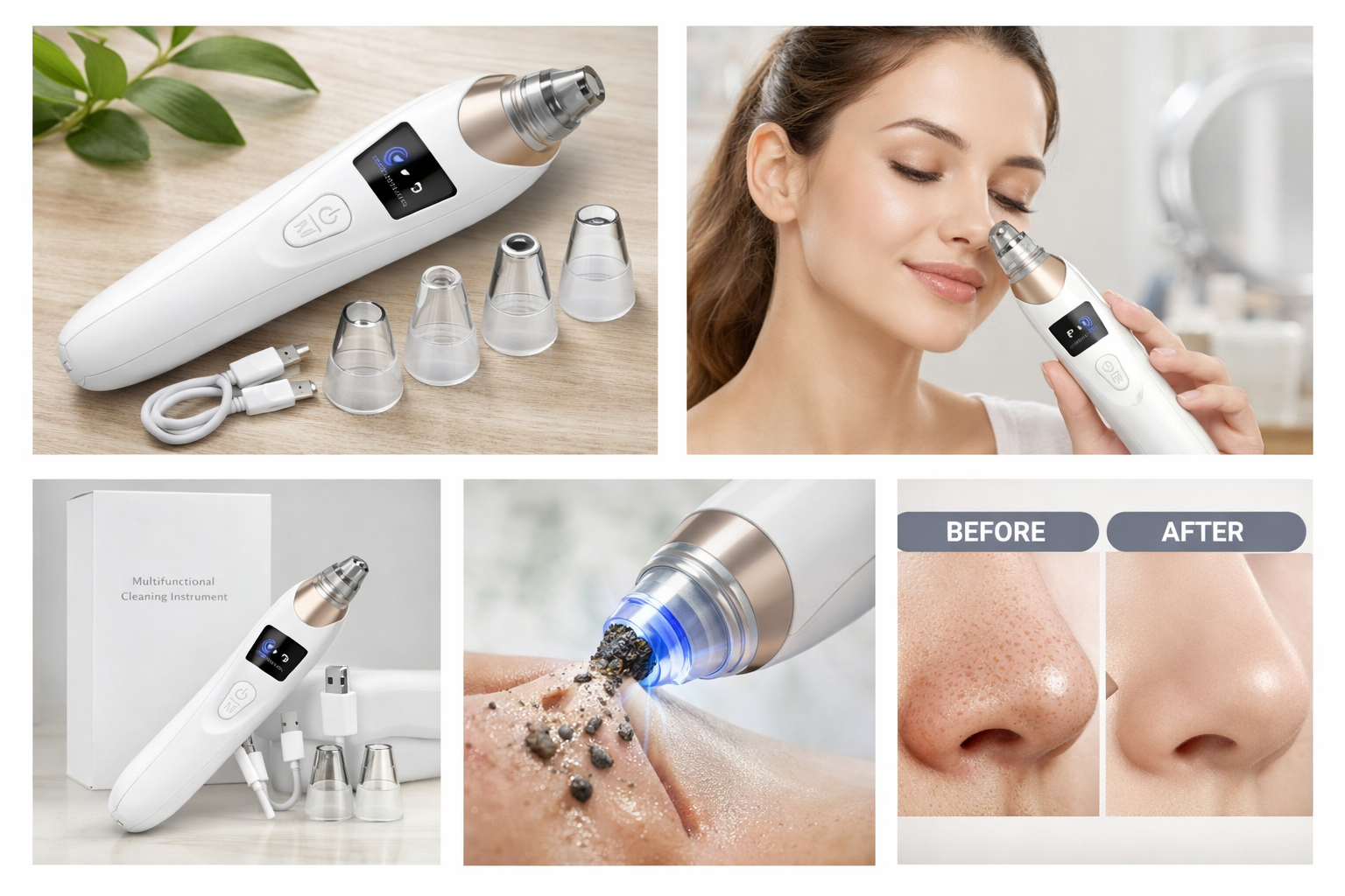 Digital Blackhead Remover Vacuum – Electric Pore Cleaner & Acne Remover