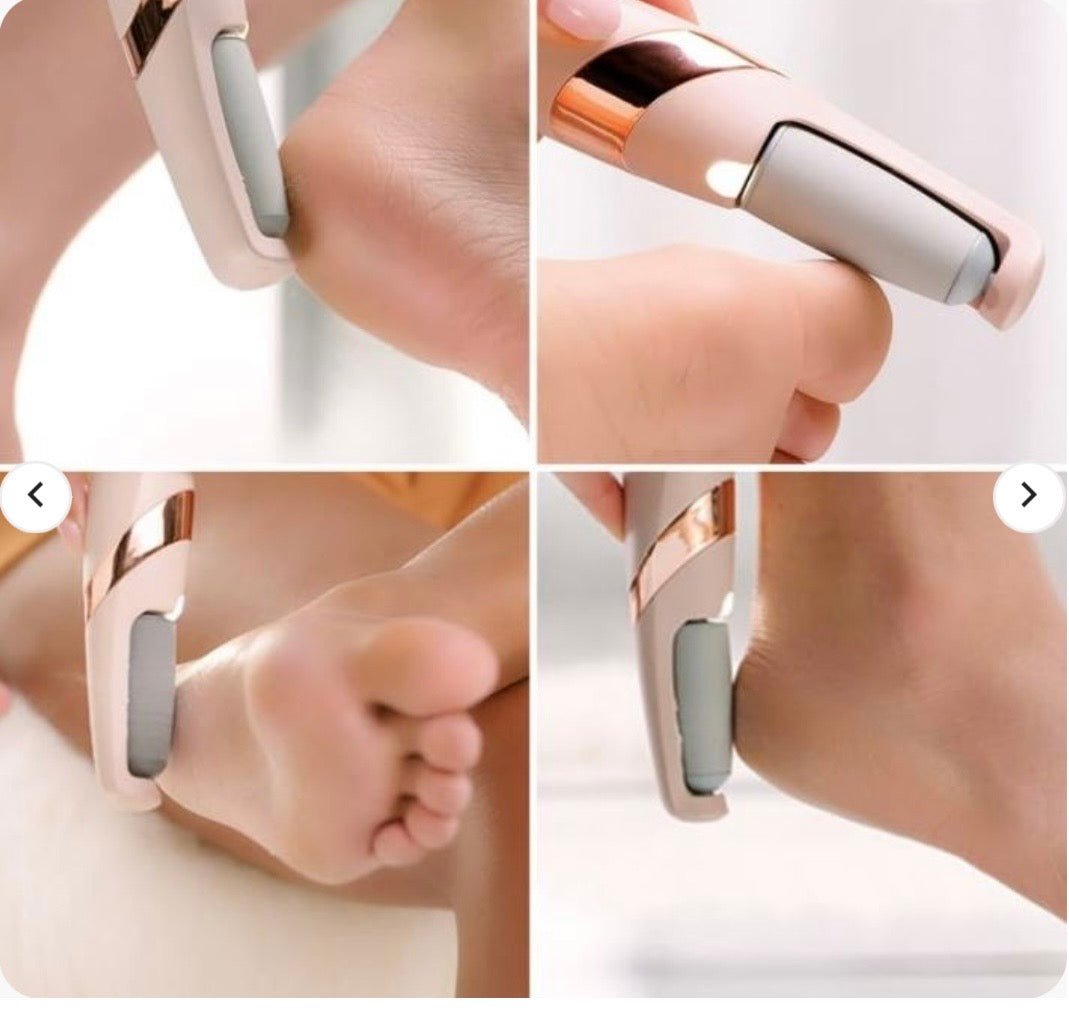 Rechargeable Electric Pedi Foot Filer – Smooth Feet Made Easy - Zovio